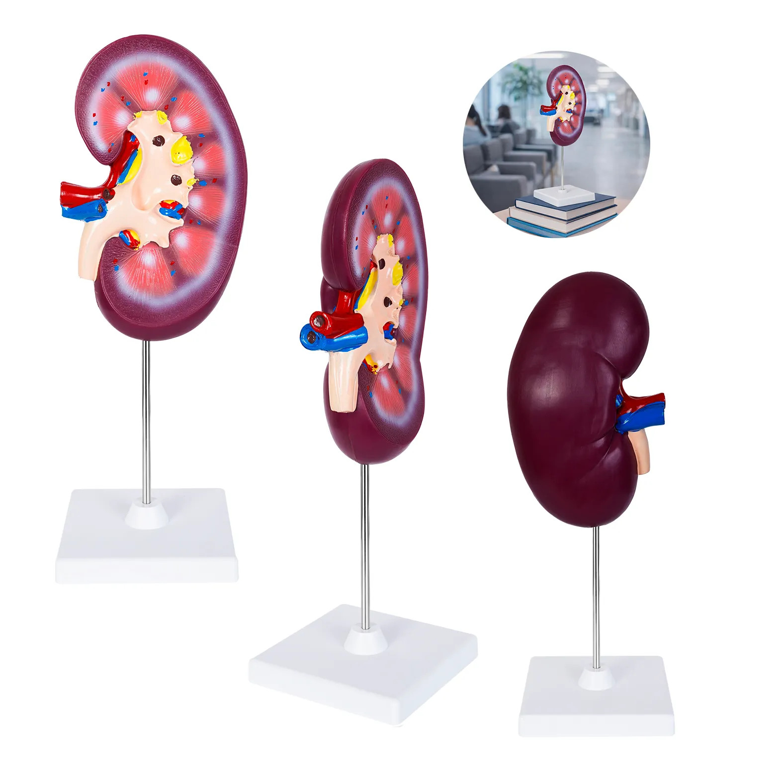 MODELO ANATOMICO NEFRO