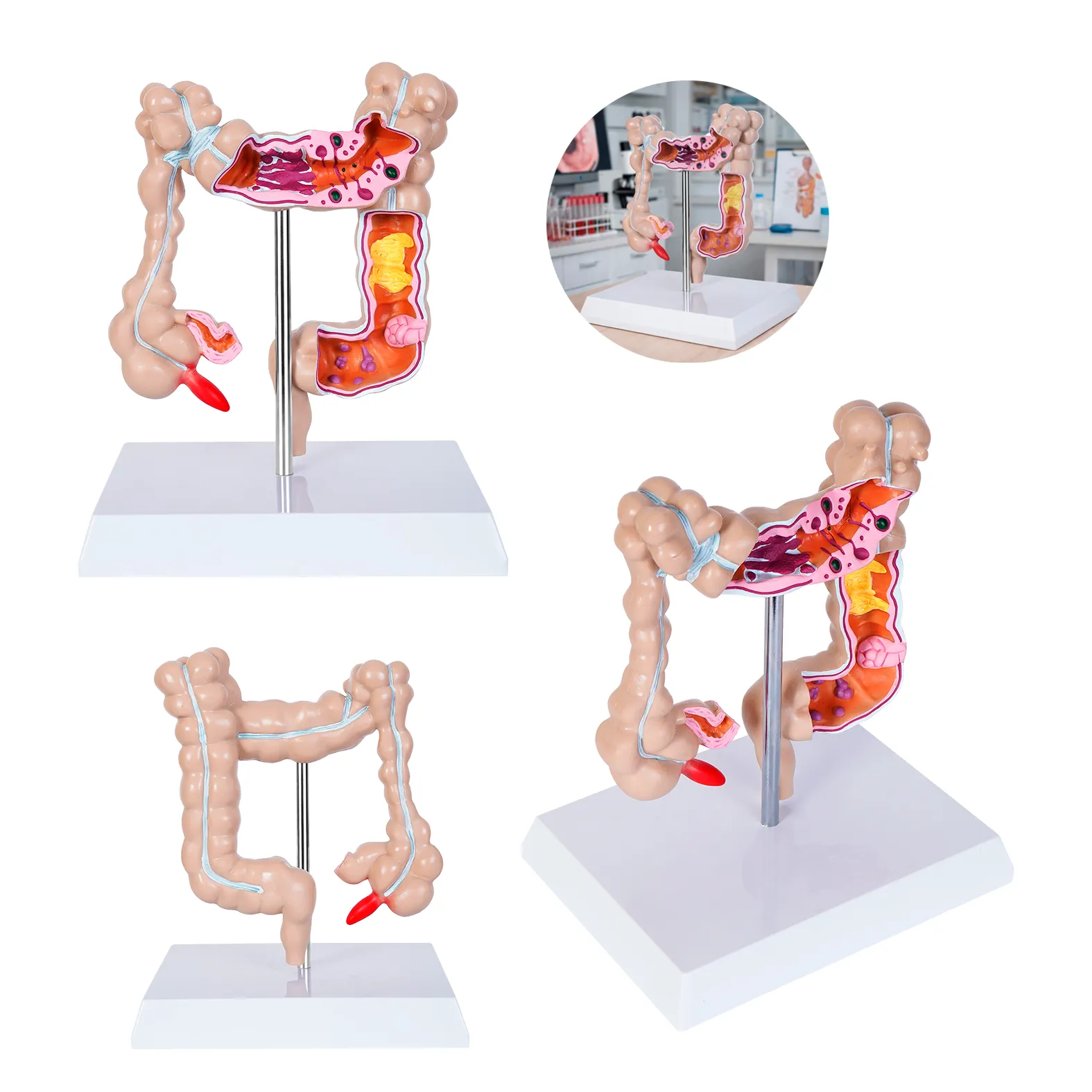 MODELO ANATOMICO COLON