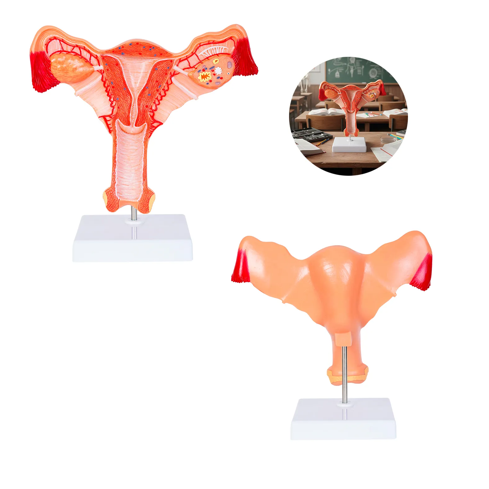 MODELO ANATOMICO ÚTERO